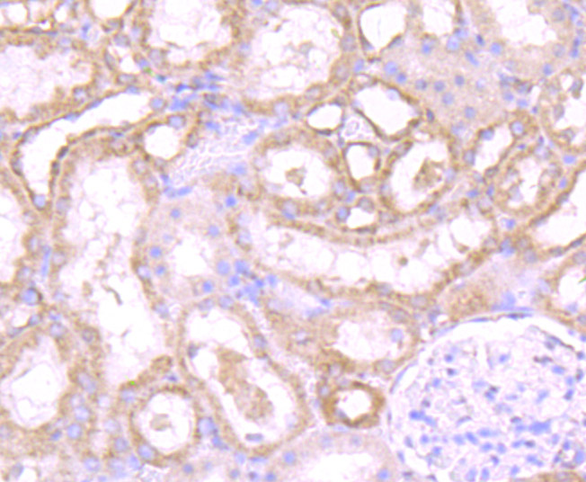 PSME1 Rabbit mAb