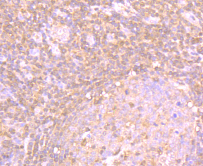 PSME1 Rabbit mAb