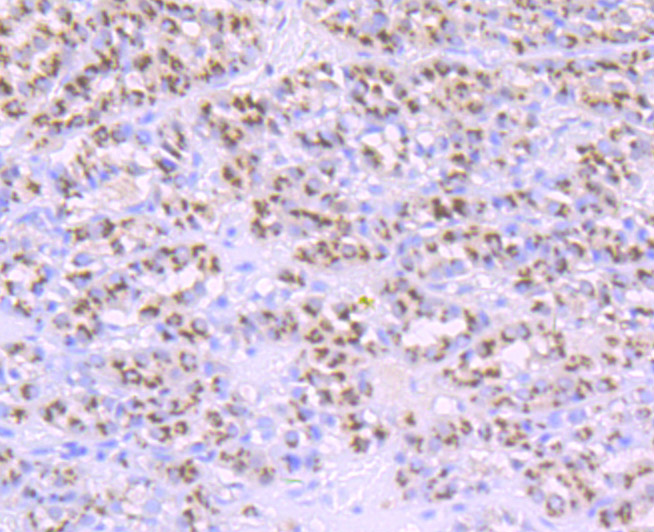 PSME1 Rabbit mAb