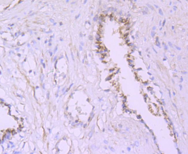 PSME1 Rabbit mAb