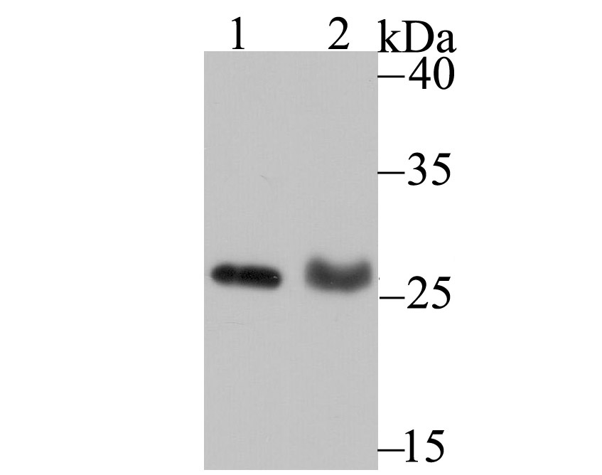 PSME1 Rabbit mAb