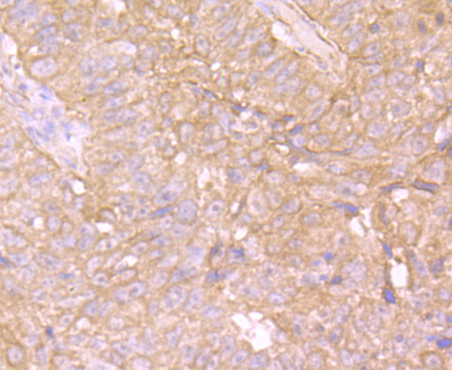 EB3 Rabbit mAb