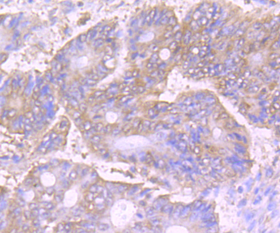 VPS35 Rabbit mAb