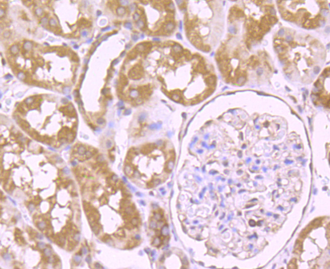 VPS35 Rabbit mAb