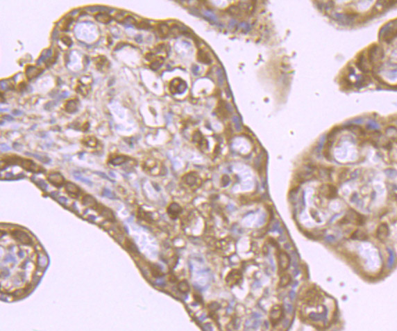 VPS35 Rabbit mAb