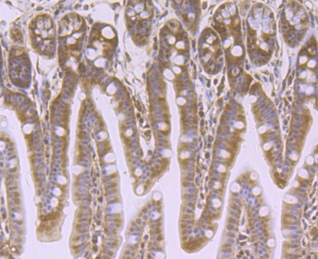 VPS35 Rabbit mAb