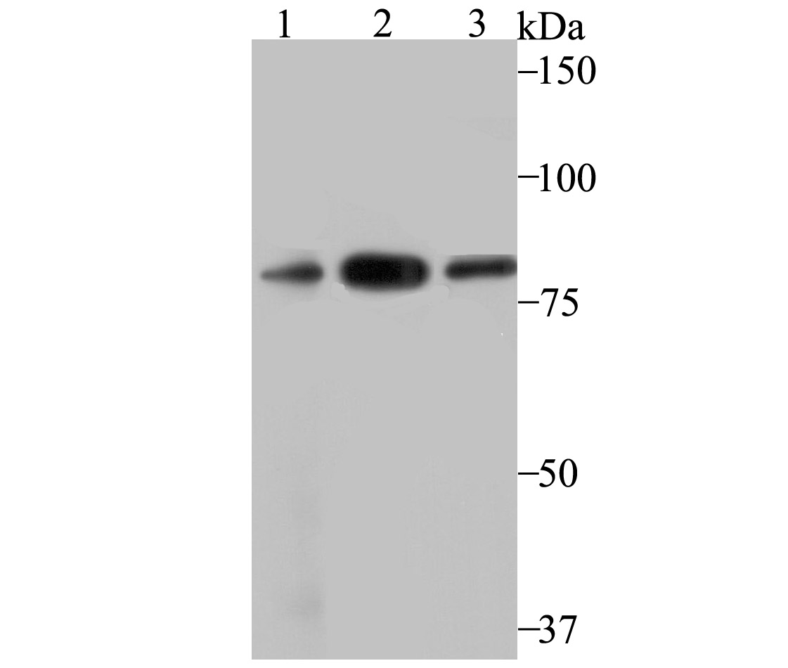 VPS35 Rabbit mAb