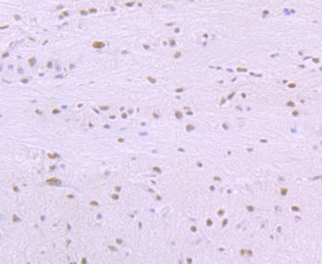 SF3B1 Rabbit mAb