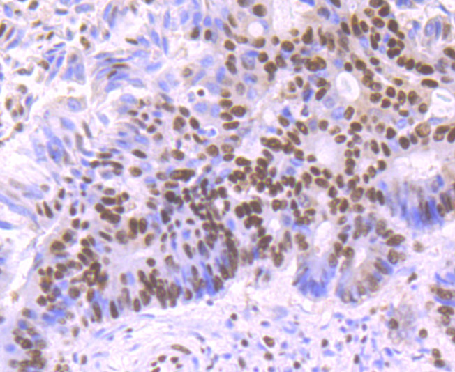 SF3B1 Rabbit mAb