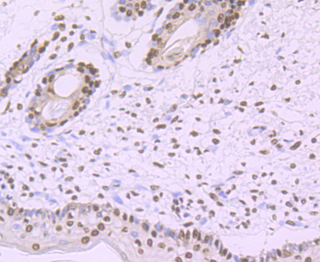 SF3B1 Rabbit mAb