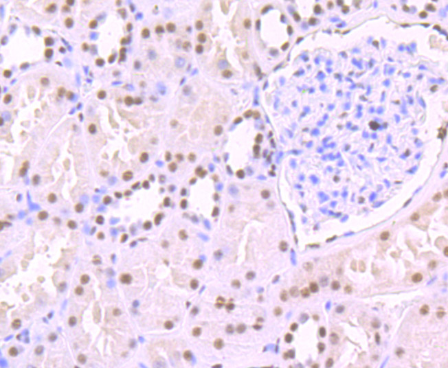 SF3B1 Rabbit mAb