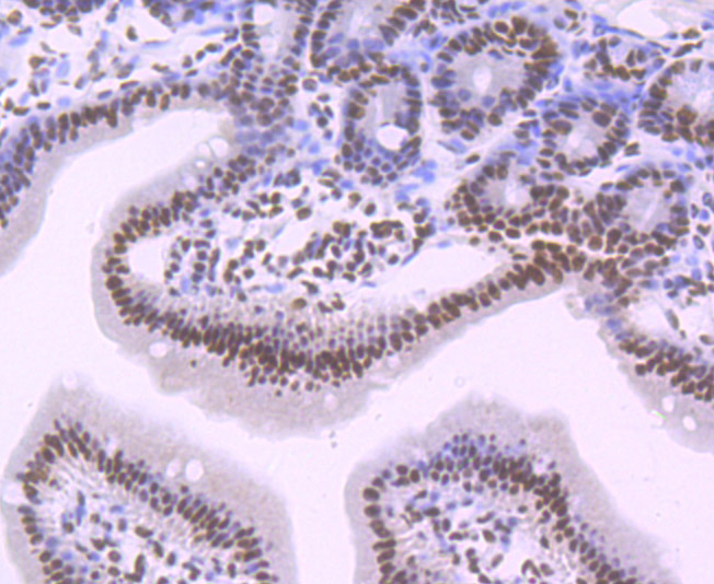 SF3B1 Rabbit mAb