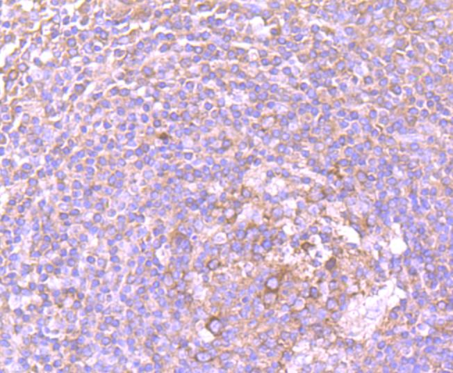 DDX6 Rabbit mAb