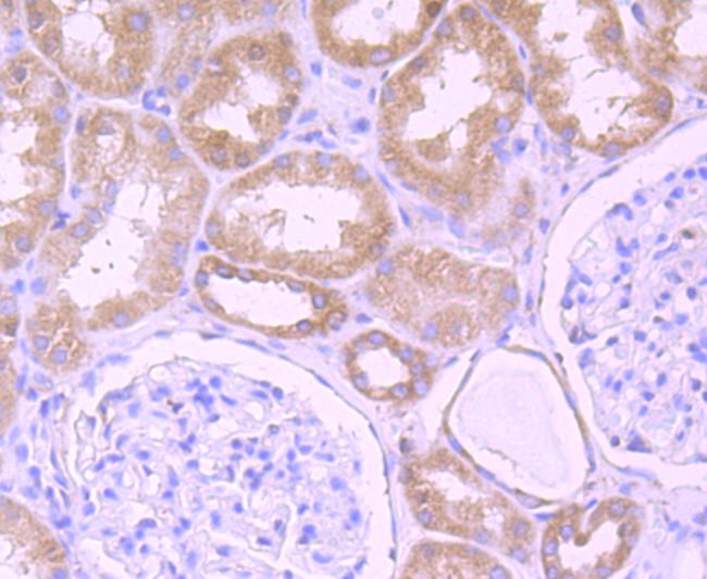 DDX6 Rabbit mAb