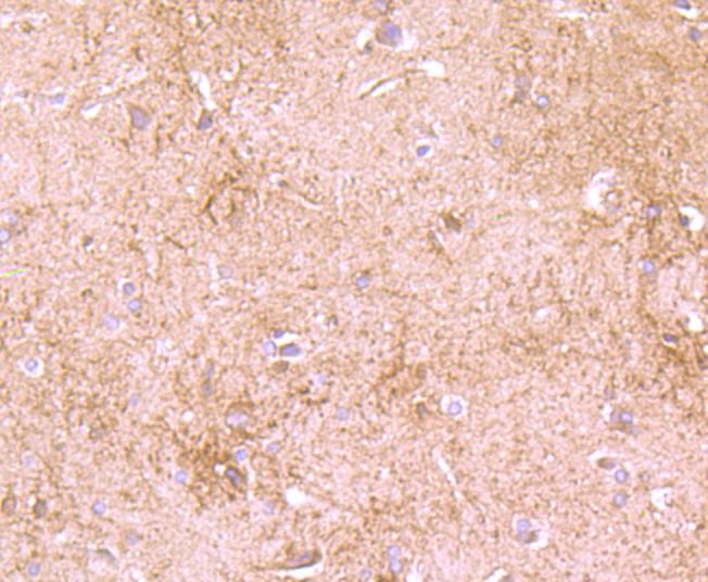 DDX6 Rabbit mAb