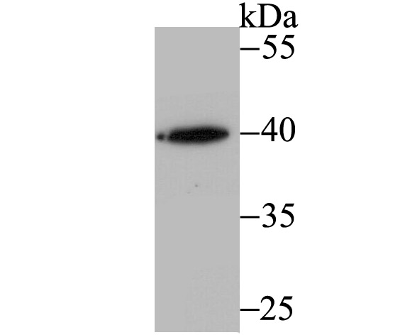 RING2 Rabbit mAb