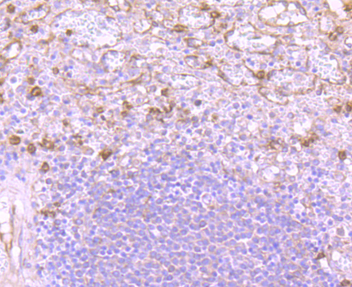 Versican Rabbit mAb