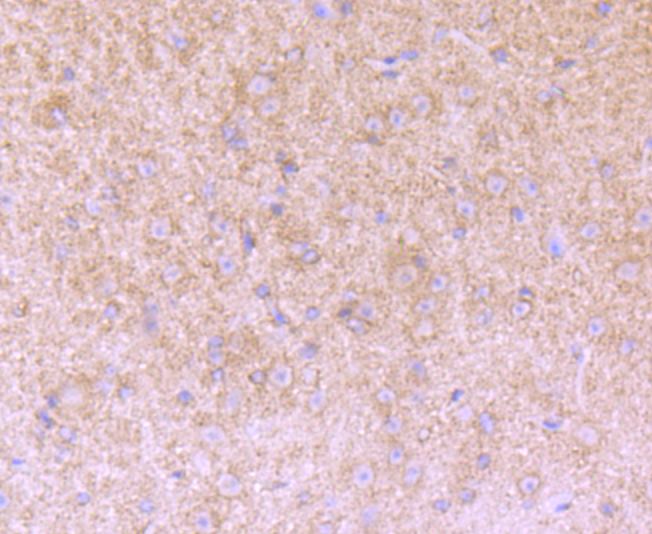 Versican Rabbit mAb