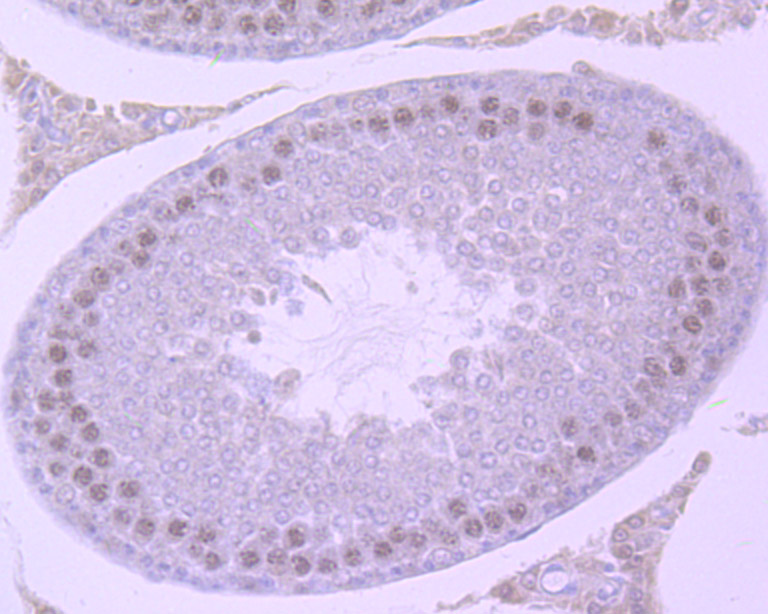 SMARCC1 Rabbit mAb