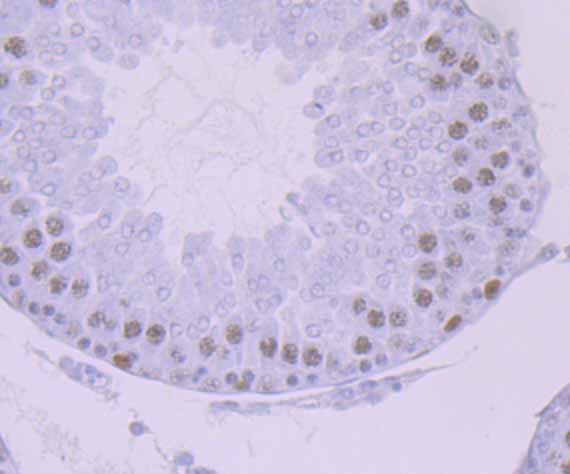 DNA Ligase I Rabbit mAb