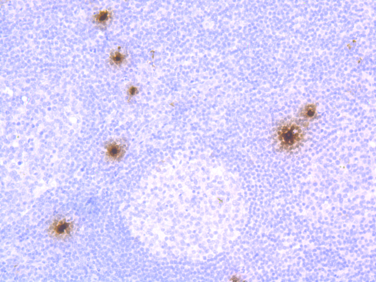 Mast Cell Chymase Rabbit mAb