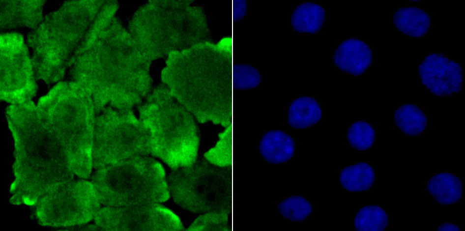 JAB1 Rabbit mAb