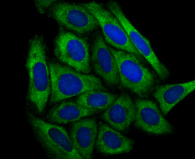 Dcp1a Rabbit mAb