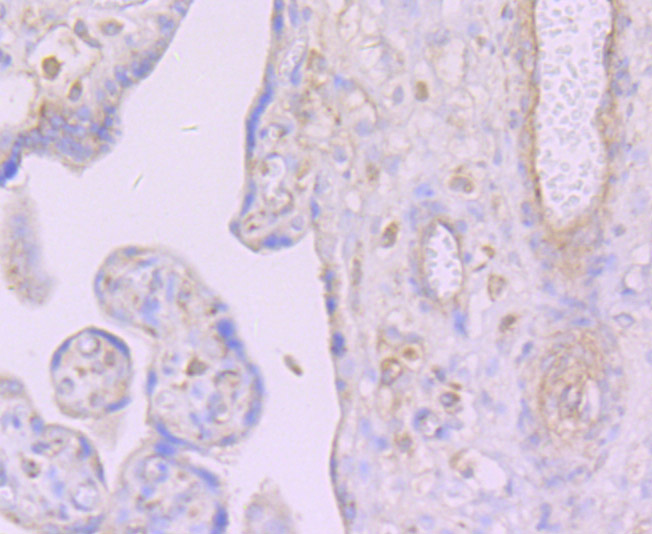 Dcp1a Rabbit mAb