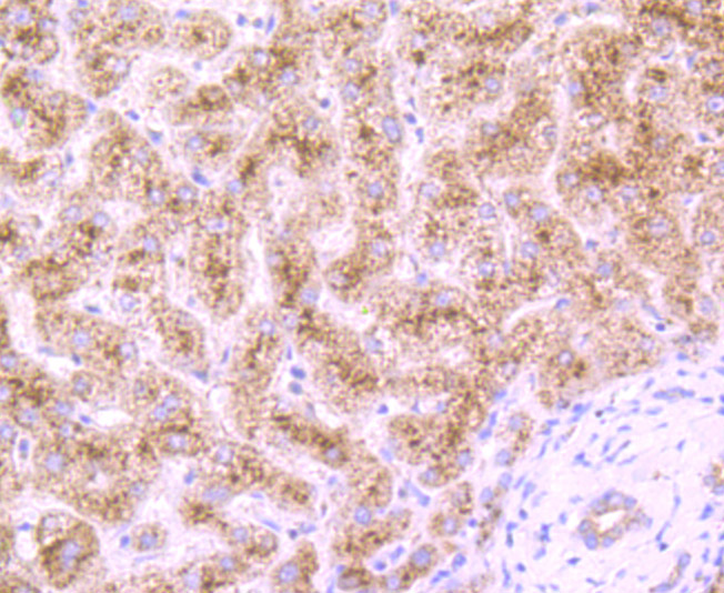 Dcp1a Rabbit mAb