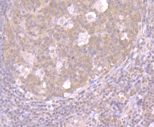 CRM1 Rabbit mAb