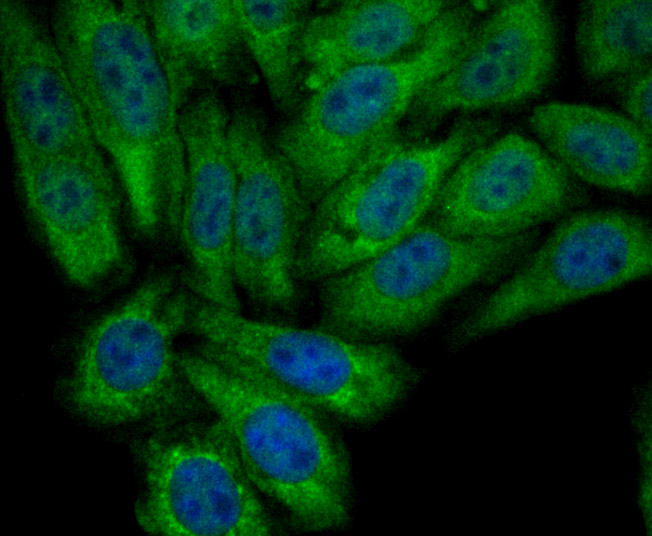 PCK2 Rabbit mAb