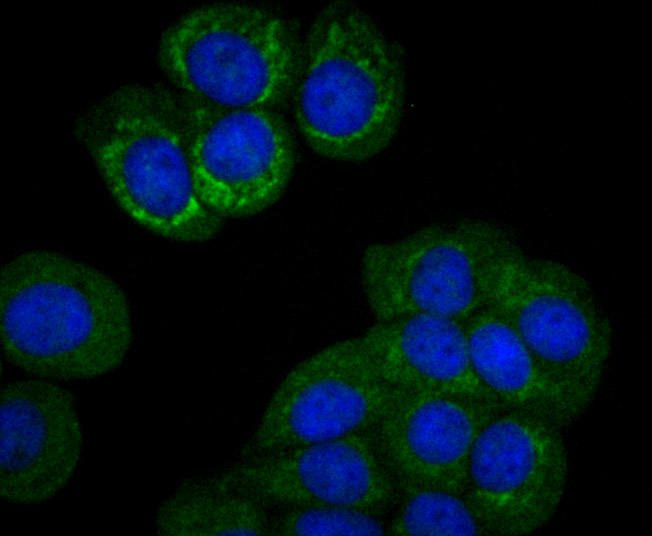 PCK2 Rabbit mAb