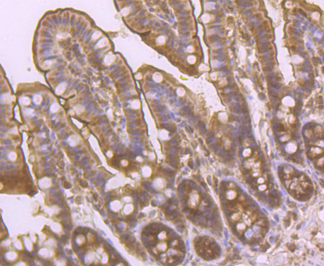 PCK2 Rabbit mAb