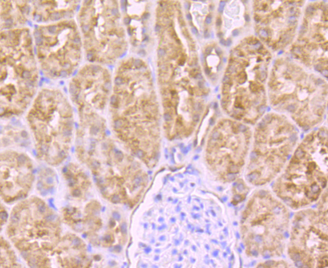 PCK2 Rabbit mAb