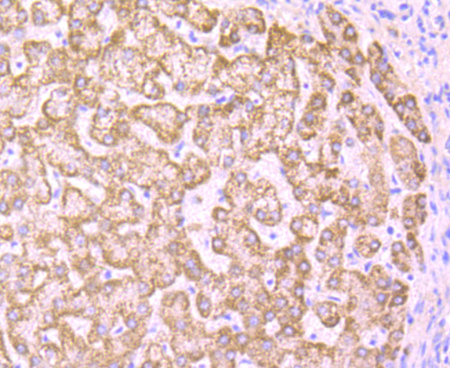 PCK2 Rabbit mAb