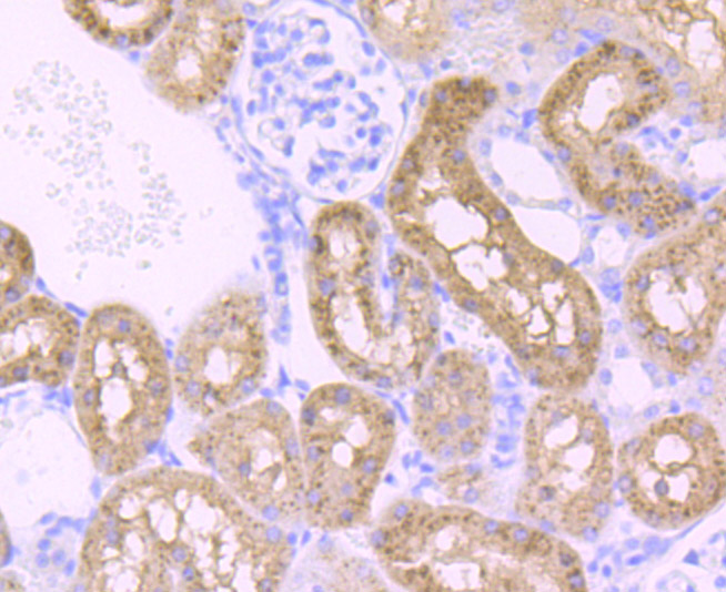 PCK2 Rabbit mAb