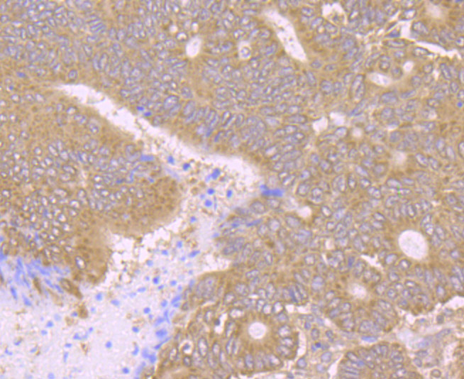 PCK2 Rabbit mAb