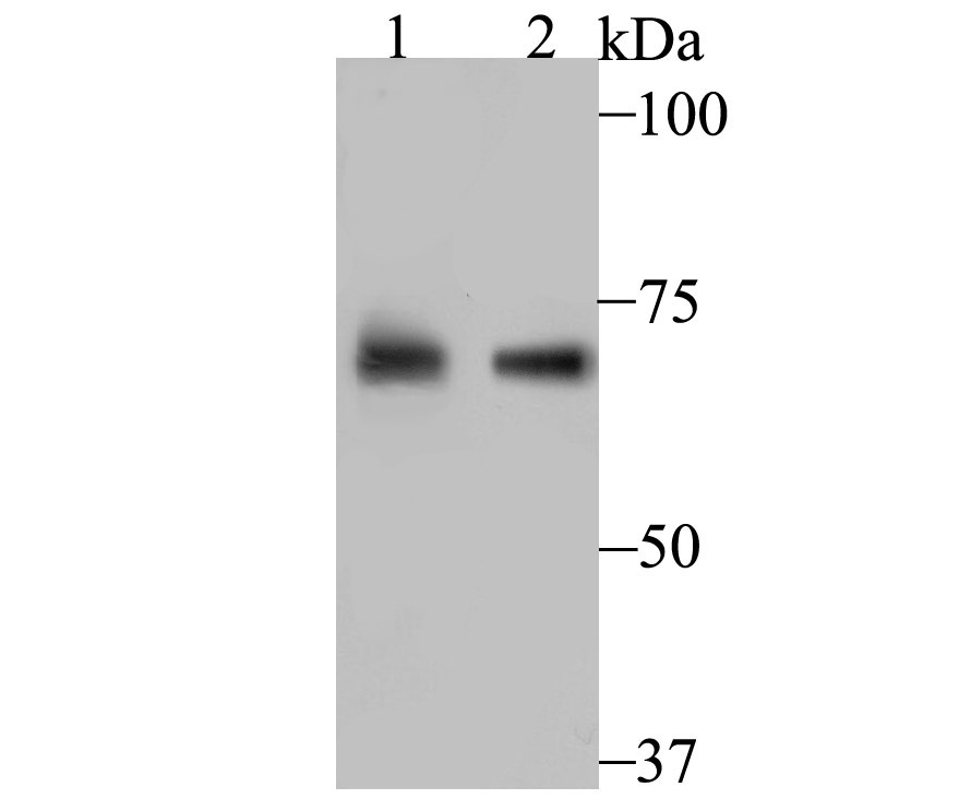 PCK2 Rabbit mAb