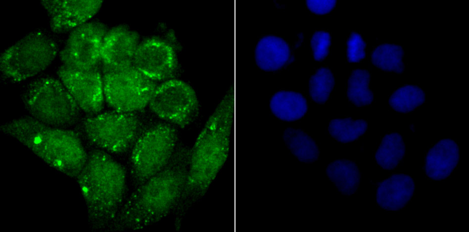 Alpha Synuclein Rabbit mAb