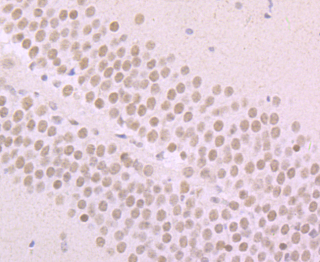 Alpha Synuclein Rabbit mAb