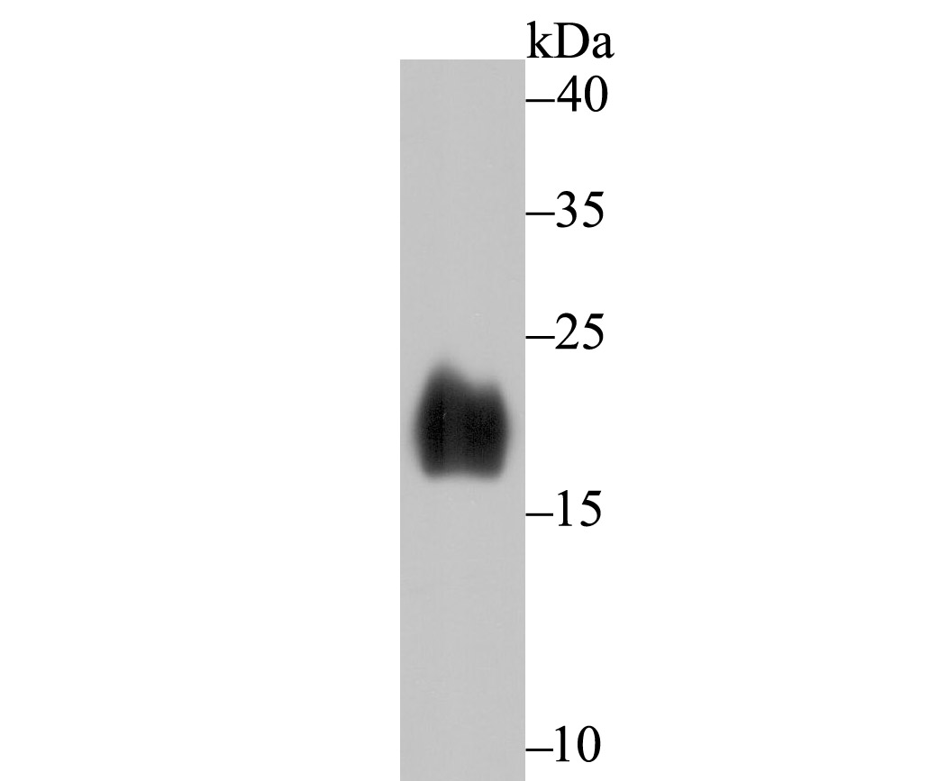 Alpha Synuclein Rabbit mAb