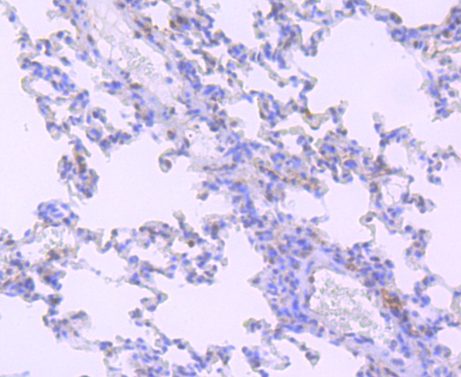 HIF-2 alpha Rabbit mAb