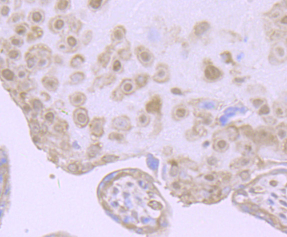 HIF-2 alpha Rabbit mAb