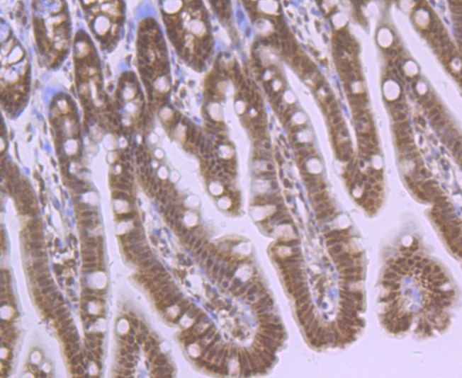 HIF-2 alpha Rabbit mAb