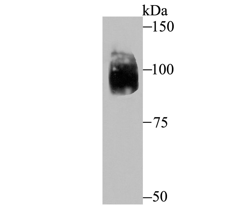 HIF-2 alpha Rabbit mAb