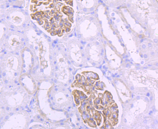 NPHS2 Rabbit mAb