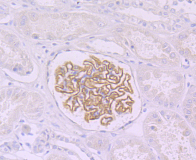 NPHS2 Rabbit mAb