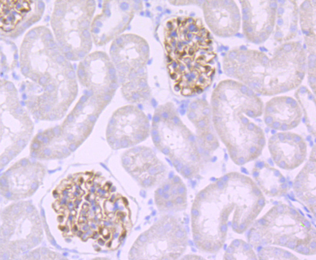 NPHS2 Rabbit mAb