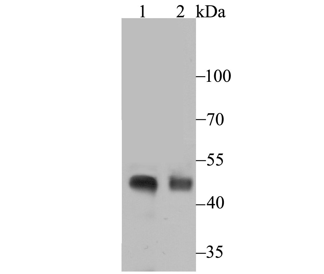 NPHS2 Rabbit mAb