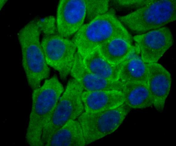 Cytochrome P450 Reductase Rabbit mAb